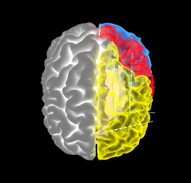 Neuromodulation of the human brain - CashLab - MGH/Harvard